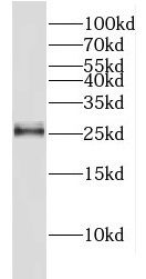 FAM119A Antibody - BSA Free