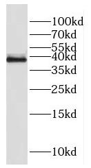 FAM118B Antibody - BSA Free