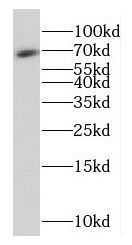 FAM117B Antibody - BSA Free