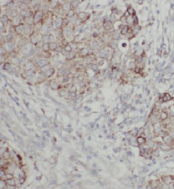 FAM117B Antibody - BSA Free