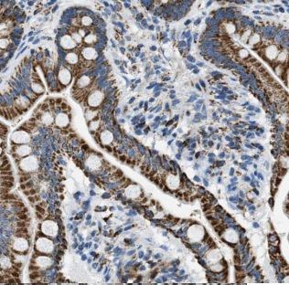 FAM111B Antibody - BSA Free