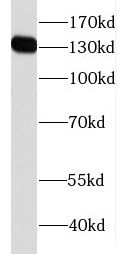 FAM111B Antibody - BSA Free