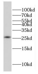 FAM101A Antibody - BSA Free
