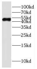 FADS3 Antibody - BSA Free