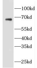 EVI2B Antibody - BSA Free