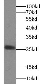 EVI2A Antibody - BSA Free