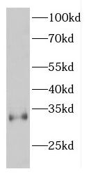 espin Antibody - BSA Free