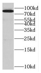 EPS8L2 Antibody - BSA Free