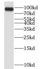 EPS15R Antibody - BSA Free