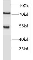 ENTPD8 Antibody - BSA Free