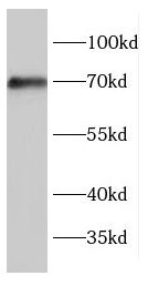 ENTPD7 Antibody - BSA Free