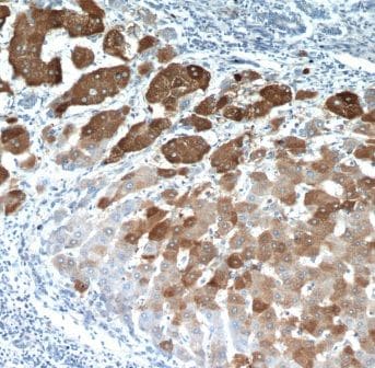 ELOVL6 Antibody - BSA Free