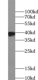 ELAVL2 Antibody - BSA Free