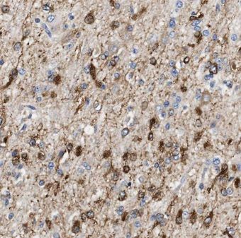Eukaryotic translation initiation factor 5B Antibody - BSA Free