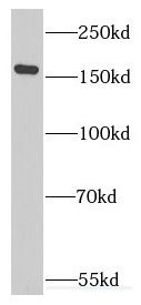 Eukaryotic translation initiation factor 5B Antibody - BSA Free