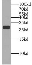 EIF4E2 Antibody - BSA Free