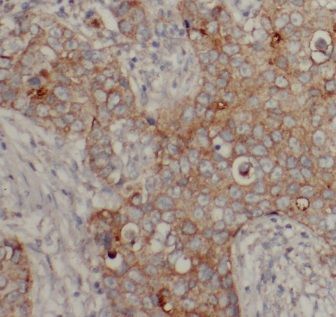 TRIP1 Antibody - BSA Free