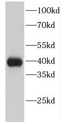 EIF2B2 Antibody - BSA Free