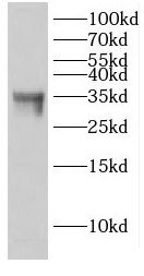 EHF Antibody - BSA Free