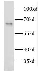 EEPD1 Antibody - BSA Free