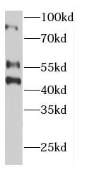 ECM2 Antibody - BSA Free