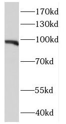 E2F7 Antibody - BSA Free