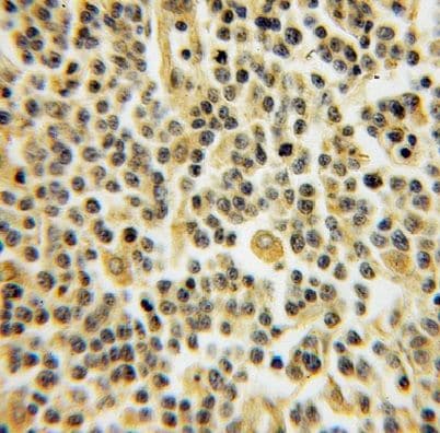 DYRK4 Antibody - BSA Free