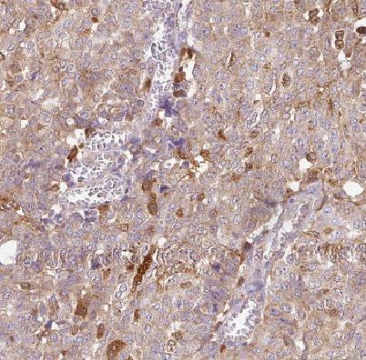 DYNLT3 Antibody - BSA Free