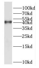 DUSP9 Antibody - BSA Free