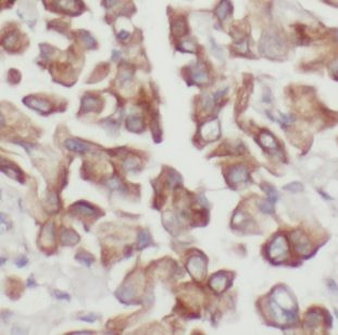 DUSP22 Antibody - BSA Free