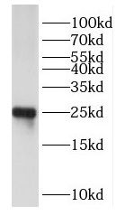 DUSP19 Antibody - BSA Free