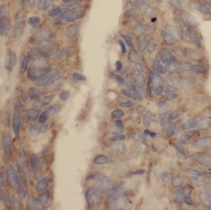 DUSP13 Antibody - BSA Free