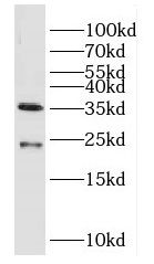DUSP13 Antibody - BSA Free
