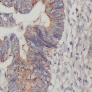 DTX1 Antibody - BSA Free