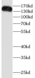 Drosha Antibody - BSA Free
