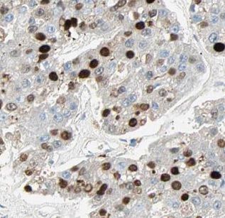 DRAP1 Antibody - BSA Free