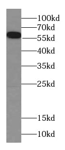 FIZ1 Antibody - BSA Free