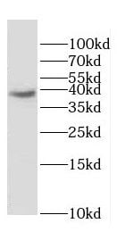 DOK6 Antibody - BSA Free