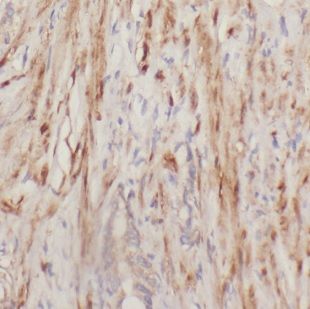 DOK4 Antibody - BSA Free