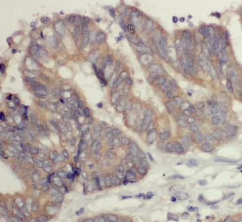 DOCK6 Antibody - BSA Free