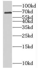 RTKN2 Antibody - BSA Free