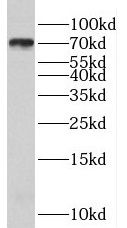 RSPH3 Antibody - BSA Free