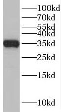 RQCD1 Antibody - BSA Free
