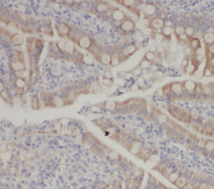 RQCD1 Antibody - BSA Free