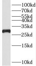 RPS4Y1 Antibody - BSA Free