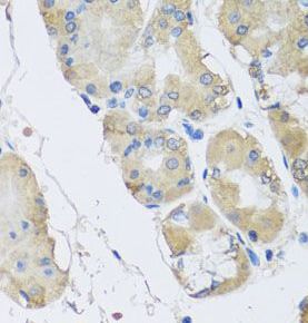RPLP1 Antibody - BSA Free