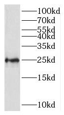 RPL10 Antibody - BSA Free