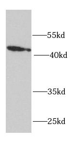 RPH3AL Antibody - BSA Free