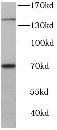 RPGRIP1 Antibody - BSA Free