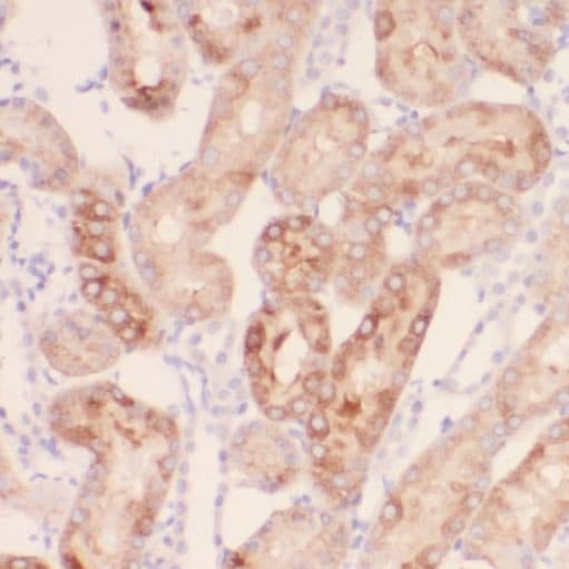 RPGR Antibody - BSA Free
